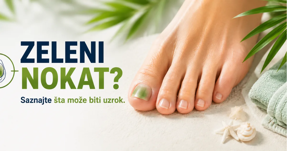 Zeleni nokat na palcu stopala — zelenkasta promena boje nokatne ploče